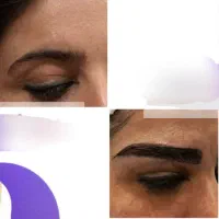 متخصص کاشت ابروتهران/قرینه/اقساطی|خدمات زیبایی و سلامت|تهران, صادقیه|دیوار