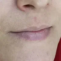 تخفیف ویژه شیدلب|خدمات آرایشگری و زیبایی|قم, انسجام|دیوار