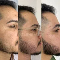 وقت جذابیت رسیده