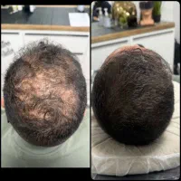 پذیرش مدل اسکالپ سر به صورت رایگان|خدمات آرایشگری و زیبایی|تهران, دروس|دیوار