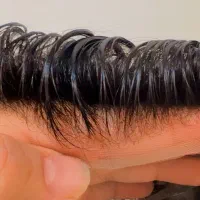 پروتزمو/شرایط ویژه پرداختی عیدانه