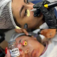 رفع تیرگی دائم بدن و صورت با کاموفلاژ