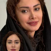 تزریق ژل و بوتاکس هایفو مزوژل|خدمات زیبایی و سلامت|تهران, شهرک شریعتی|دیوار