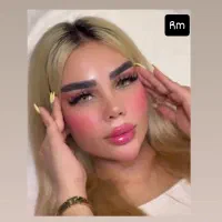 ۵۰ درصد تخفیف تزریق صورت سبک عربی هالیوودی لب روسی