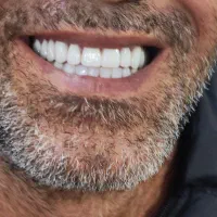 دندانسازی (فقط با ۱۵ میلیون )|خدمات آرایشگری و زیبایی|پرند, فاز ۲|دیوار