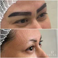 کاشت مو و‌ابرو تخصصی