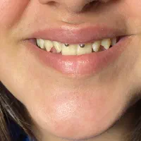 پیرسینگ بدون درد و خونریزی