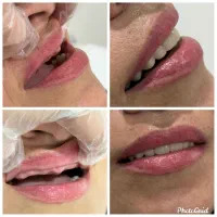 ساخت دندان مصنوعی