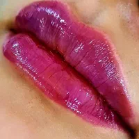 ژل و بوتاکس با قیمت باورنکردنی ظرفیت محدود|خدمات آرایشگری و زیبایی|کاشان, درب اصفهان|دیوار