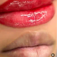 میکروشیدلب