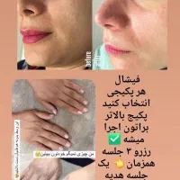 پاکسازی صورت، کمر، دست وپا
