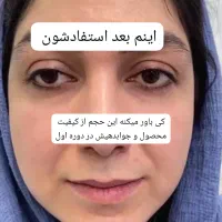 کرم ضد لک تخصصی|آرایشی، بهداشتی، درمانی|ایرانشهر, |دیوار