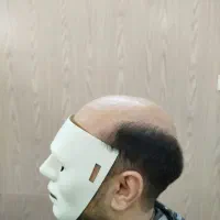 پروتز و ترمیم موی افشان|خدمات آرایشگری و زیبایی|مشهد, کوثر|دیوار