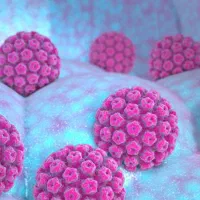 درمان زگیل تناسلی توسط پزشک