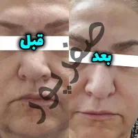 زیبایی با محصول ما تست کن|آرایشی، بهداشتی، درمانی|لاهیجان, رجایی|دیوار