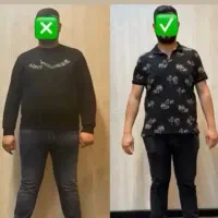 امبدینگ لاغری (ساختمان پزشکان رفاه پاکدشت)|خدمات آرایشگری و زیبایی|پاکدشت, پاکدشت (مامازند)|دیوار