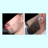 کاشت ریش ممنوع