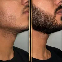 رویش ۱۰۰٪ ریش و سبیل
