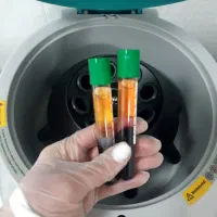 فیلر ، بوتاکس ، فیشال ، لیزر ، پی آر پی|خدمات آرایشگری و زیبایی|اندیشه, اندیشه فاز ۱|دیوار