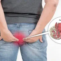 بهبود و درمان بواسیر شقاق وهموریید