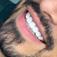 کامپوزیت اف اخر سال اهواز