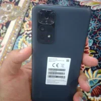 note 11 s ، آس ، تمیز|موبایل|قم, شهرک فاطمیه|دیوار