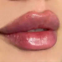 تزریق ژل لب، لیفت نخ بوتاکس در نارمک