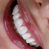 دندون پزشکی