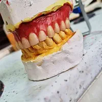 پروتز دندان