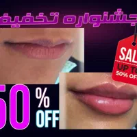 جشنواره لیزر مو تزریق ژل لب بوتاکس فیلر لیفت صورت|خدمات آرایشگری و زیبایی|تهران, ستارخان|دیوار
