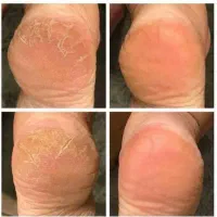 پدیکور و مانیکور حرفه ای با تخفیف تابستانه|خدمات آرایشگری و زیبایی|کرج, بنیاد|دیوار