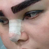 جشنوارهکاشت مو و ابرو و ریش وسبیل|خدمات آرایشگری و زیبایی|زاهدان, |دیوار