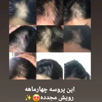 دفتر رسمی نمایندگی سرم سیر سیاه پرپشتی مو و ریش|آرایشی، بهداشتی، درمانی|مشهد, طبرسی شمالی|دیوار