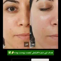 فروش تکی وعمده|فعالیت داوطلبانه|کرج, کوی زنبق|دیوار