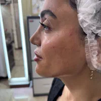 کلینیک تزریق ژل و بوتاکس|خدمات آرایشگری و زیبایی|تهران, حسن‌آباد|دیوار