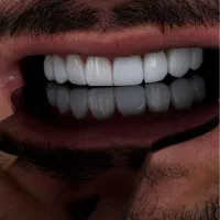ایمپلنت وکامپوزیت دندونپزشکی|خدمات آرایشگری و زیبایی|تهران, آهنگ|دیوار
