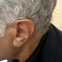 سمعک برتر|پزشکی|تهران, زرگنده|دیوار