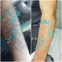 پاک کردن تاتوهای قدیمی وجدید مثل حیوانات ونوشتاری|خدمات آرایشگری و زیبایی|قم, بلوار امین و ساحلی|دیوار