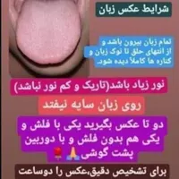 پک لاغری وچاقی|آرایشی، بهداشتی، درمانی|تهران, جنت‌آباد مرکزی|دیوار
