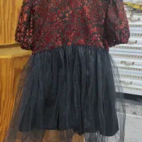 چند عدد پیراهن دخترانه