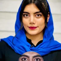 جراحی بینی بامتخصص گوش وحلق وبینی