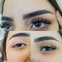 مدل کاشت هیدن