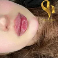 آف ژل بوتاکس از 800