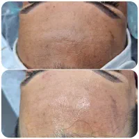 اموزشگاه ومرکز تخصصی پوست|خدمات آموزشی|زرند, |دیوار