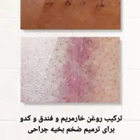 راه کار در منزل|آرایشی، بهداشتی، درمانی|لامرد, |دیوار