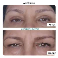 خدمات زیبایی اقساطی کلینیک دکتر خجسته|خدمات آرایشگری و زیبایی|گلبهار, شهر جدید گلبهار|دیوار