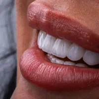 دندانپزشکی تخصصی ایمپلنت،ارتودنسی،روکش ،کامپوزیت|خدمات آرایشگری و زیبایی|مرند, |دیوار
