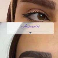 جشنواره بوتاکس|خدمات آرایشگری و زیبایی|اردبیل, |دیوار