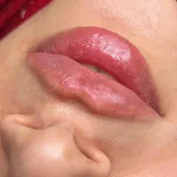 جشنواره تزریق فیلر،بوتاکس ،نخ،لاغری و هایفو|خدمات آرایشگری و زیبایی|تبریز, |دیوار