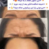 کرم بوتاکس گاتیو|آرایشی، بهداشتی، درمانی|خمام, |دیوار